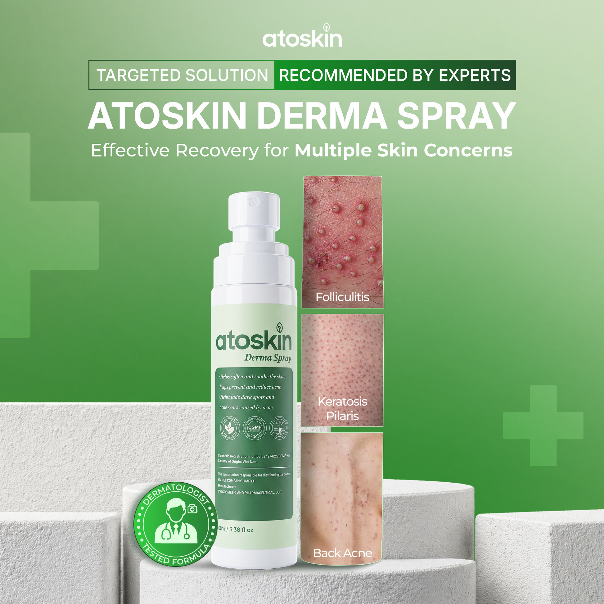 Xịt Mụn Cơ Thể ATOSKIN
