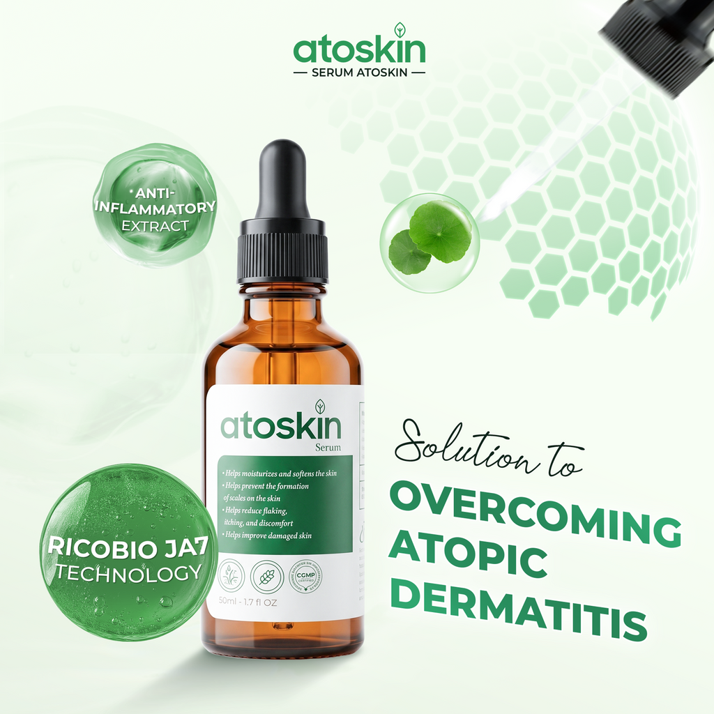 Serum Viêm Da Cơ Địa ATOSKIN 50ml