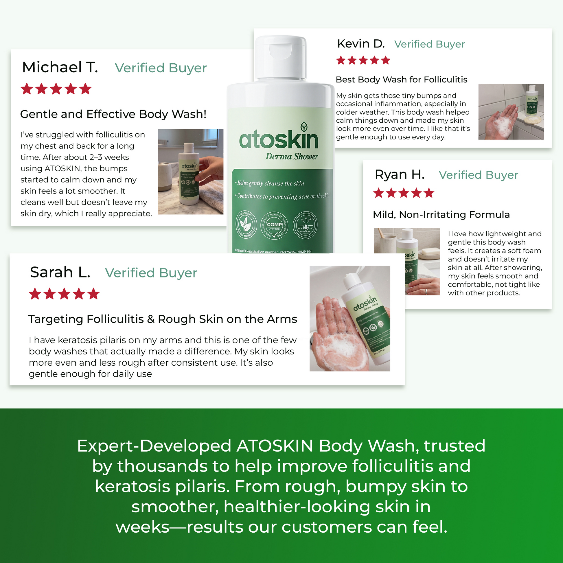 Sữa Tắm Mụn Cơ Thể ATOSKIN 280ml