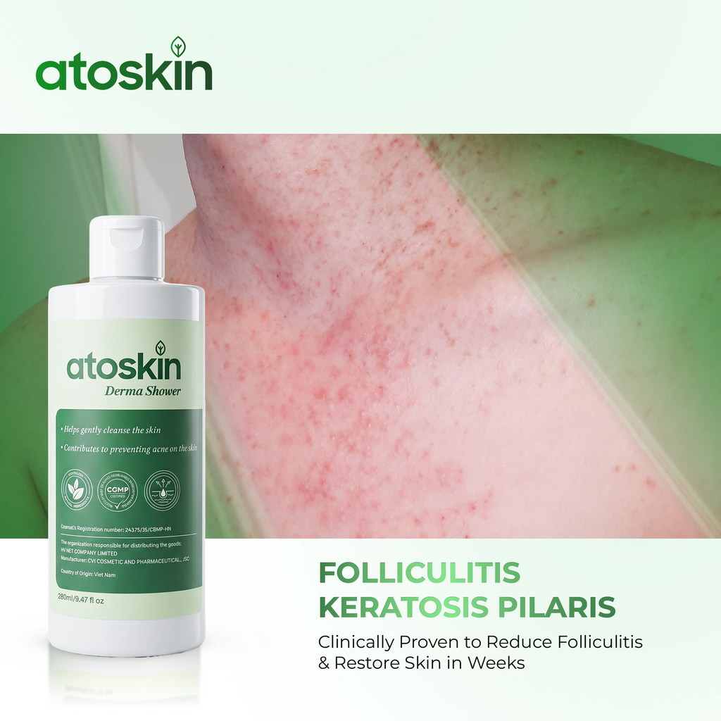 Sữa Tắm Mụn Cơ Thể ATOSKIN 280ml