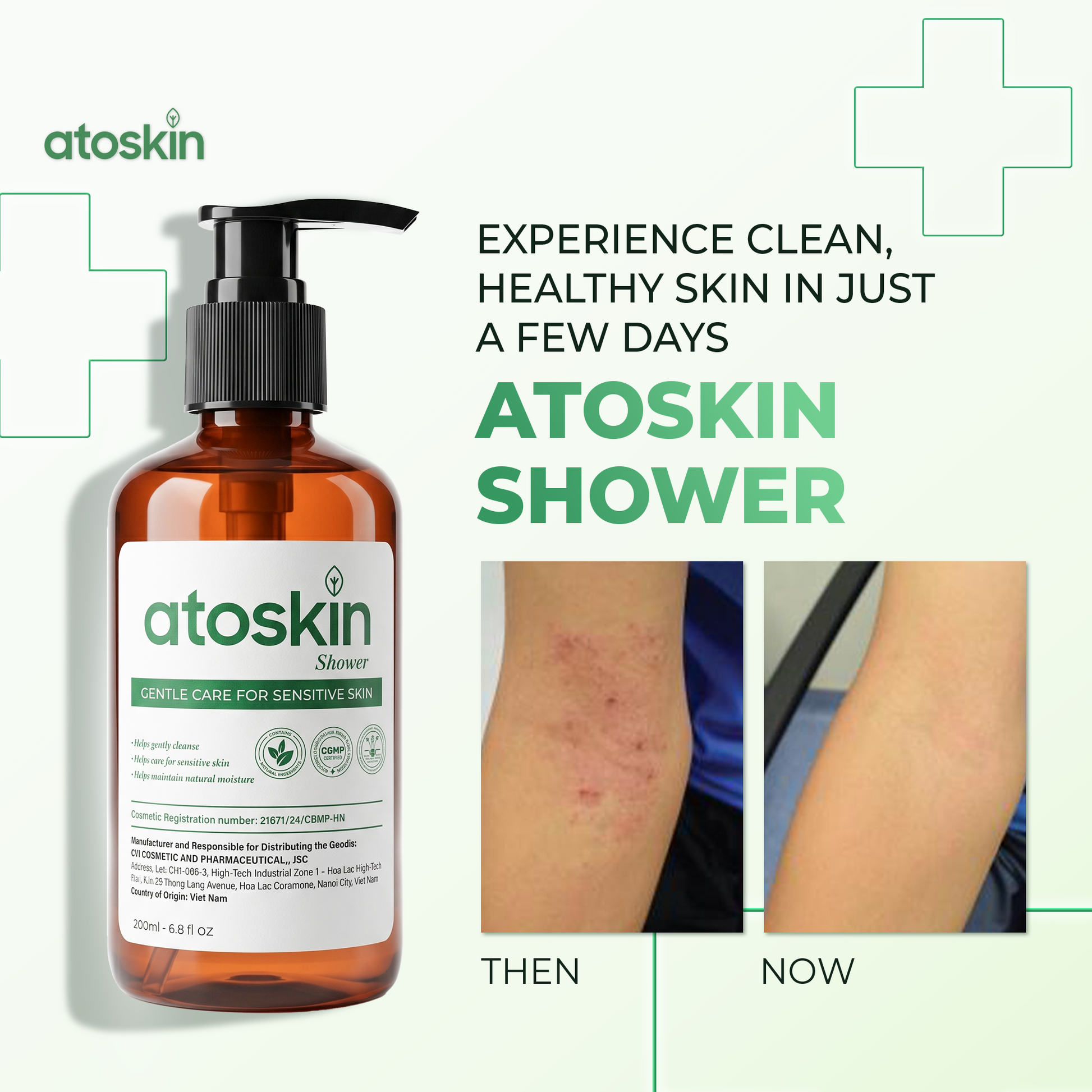 Sữa Tắm Viêm Da Cơ Địa Atoskin 200ml