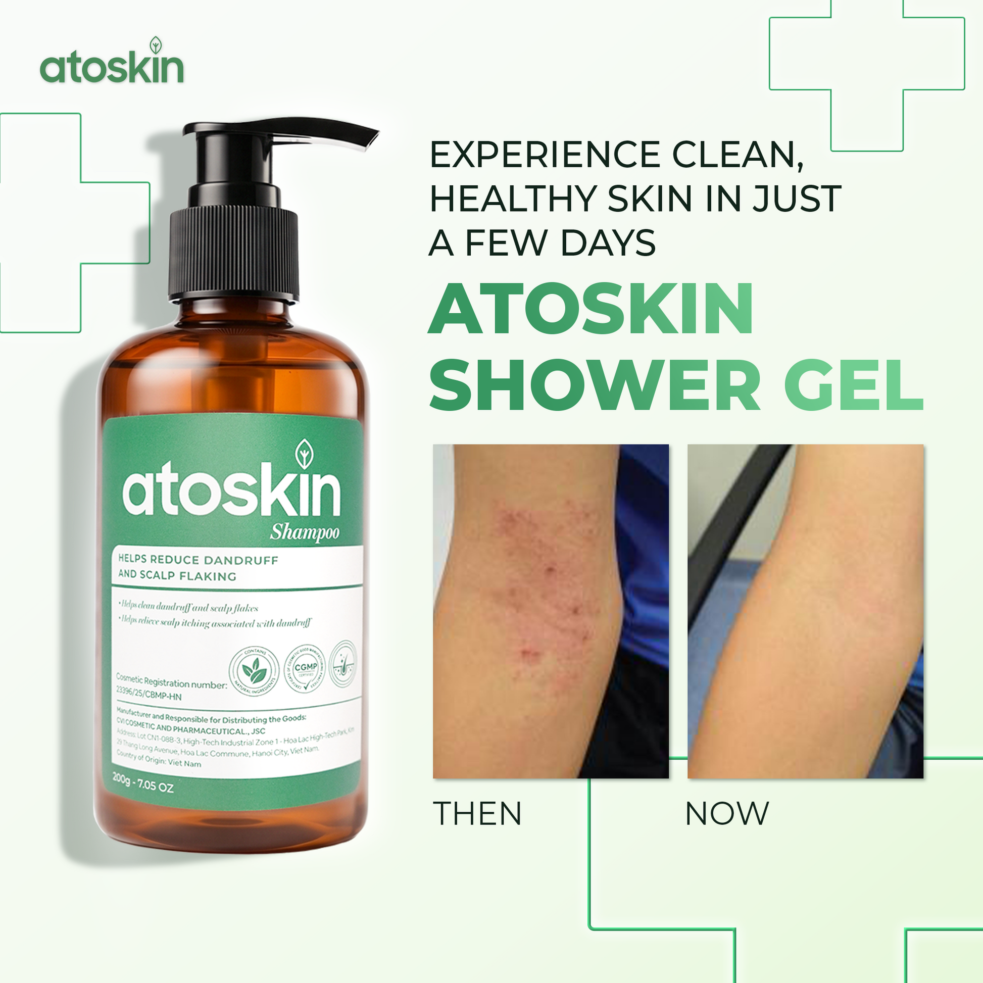 Dầu Gội Viêm Da Tiết Bã ATOSKIN 200g