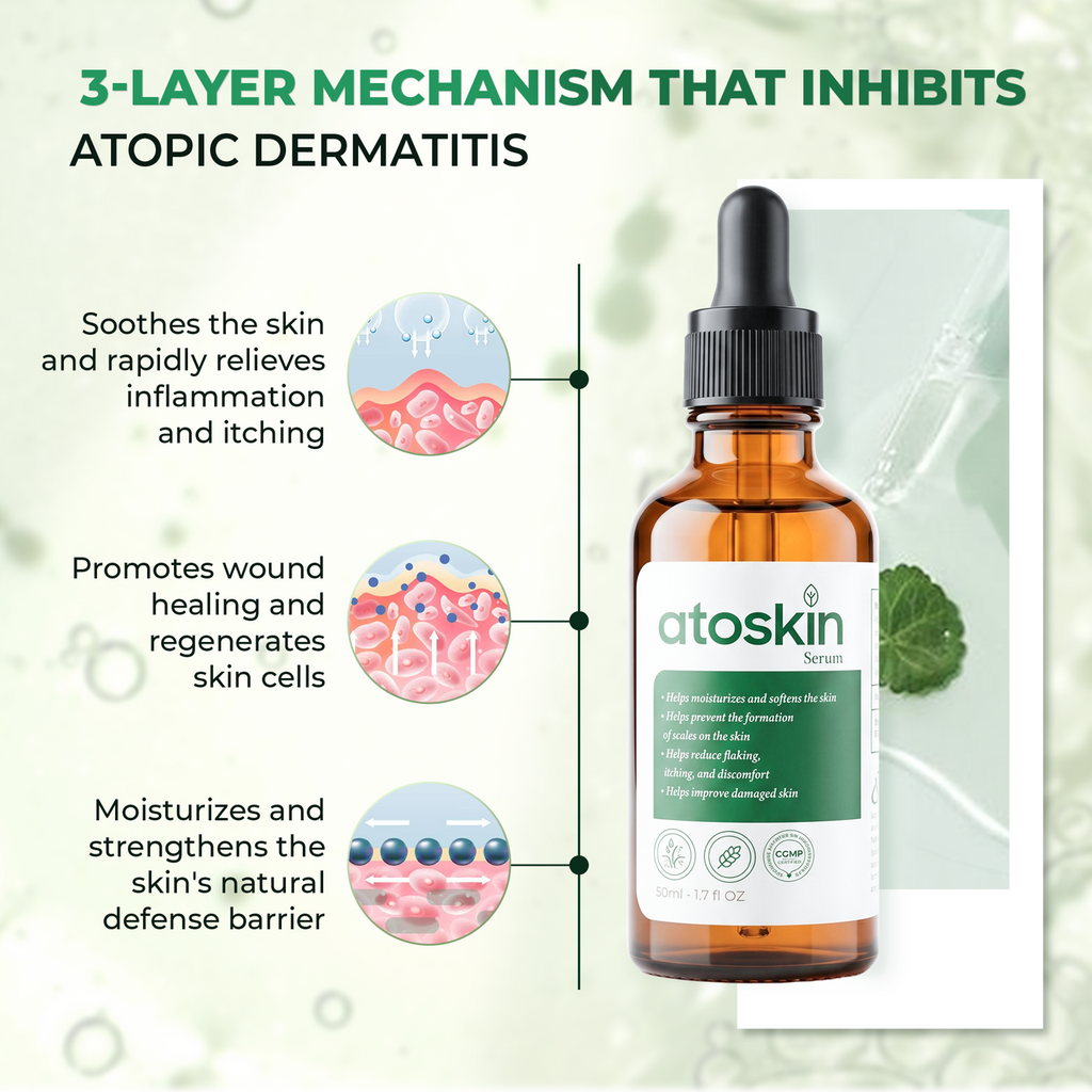 Serum Viêm Da Cơ Địa ATOSKIN 50ml