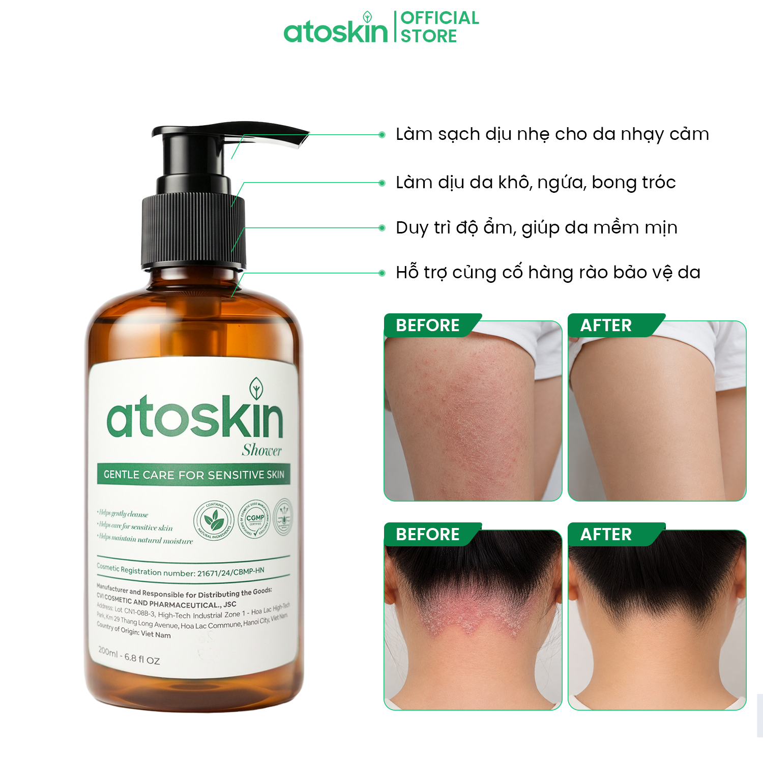 Sữa Tắm Viêm Da Cơ Địa ATOSKIN Shower 280ml