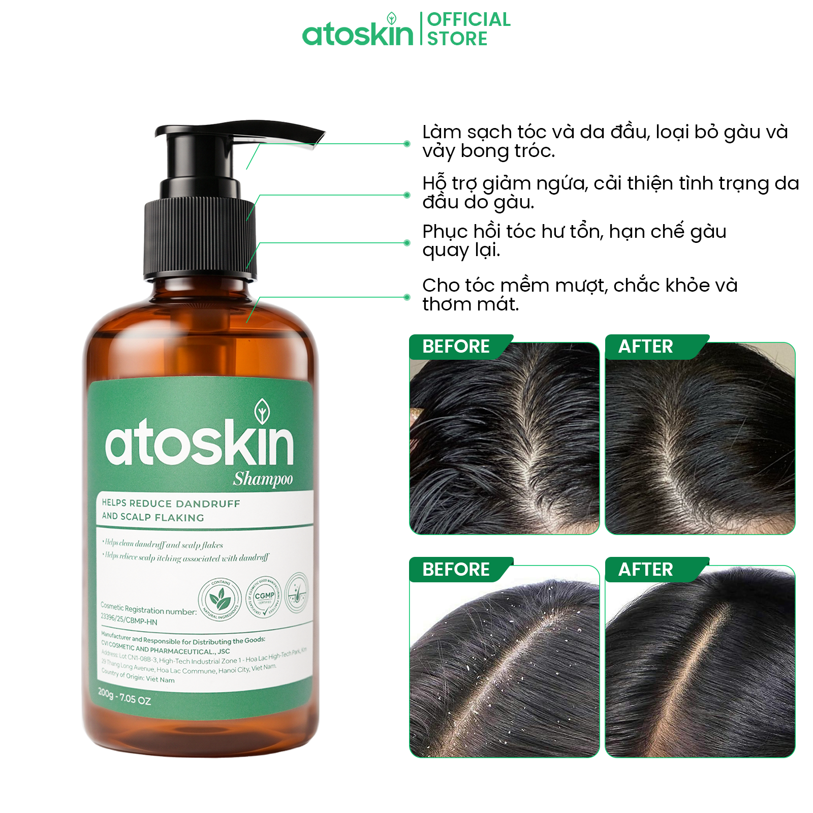 Dầu Gội Viêm Da Tiết Bã ATOSKIN Shampoo 200g