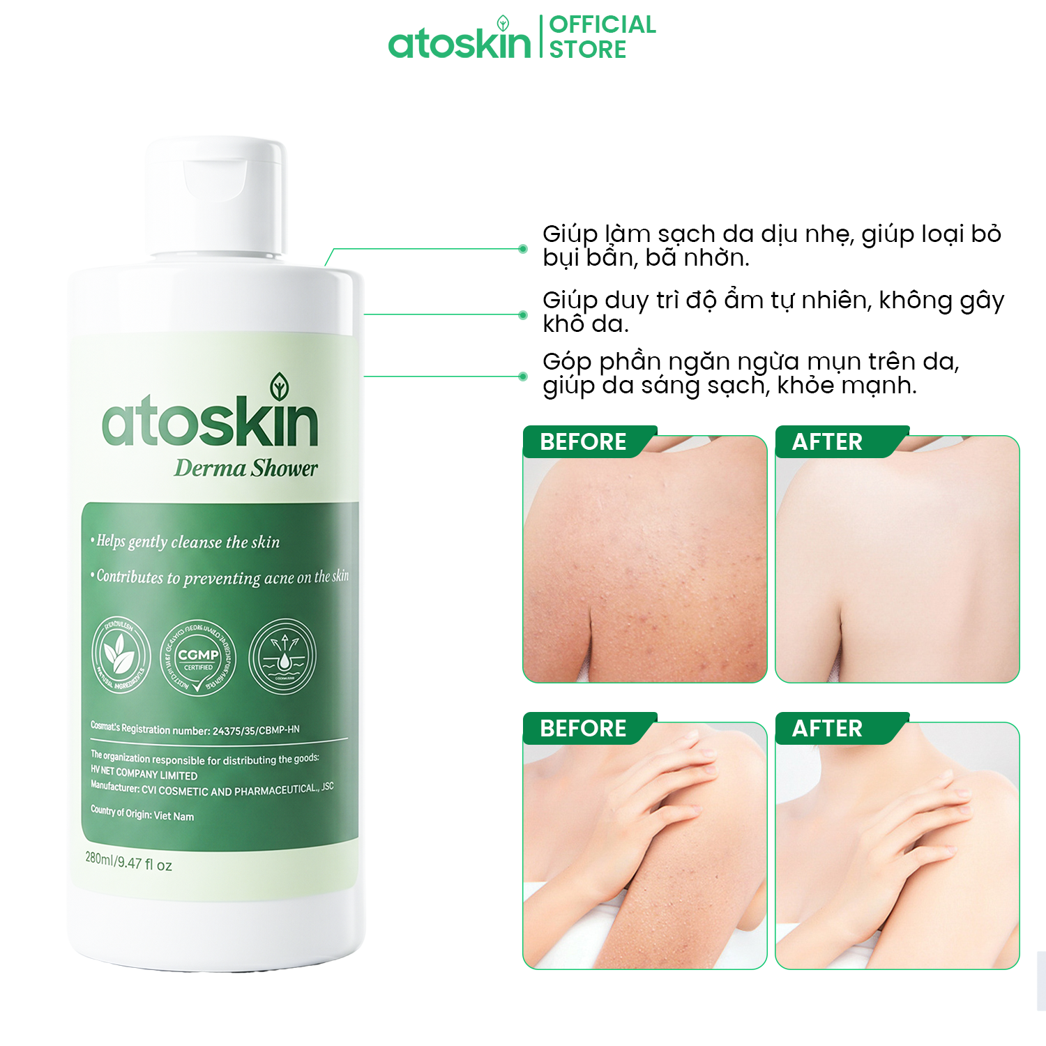 Sữa Tắm Mụn Cơ Thể ATOSKIN Derma Shower 280ml