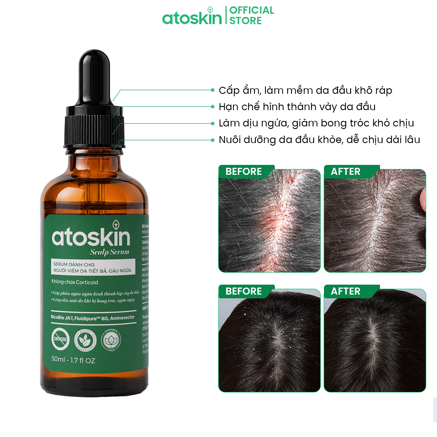 Serum Viêm Da Tiết Bã ATOSKIN Scalp Serum 50ml