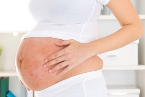 Bà bầu bị viêm da cơ địa