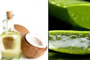 chữa bệnh chàm bằng dầu dừa