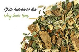 Chữa viêm da cơ địa bằng thuốc nam