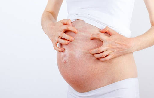 Điều trị viêm da cơ địa ở phụ nữ mang thai